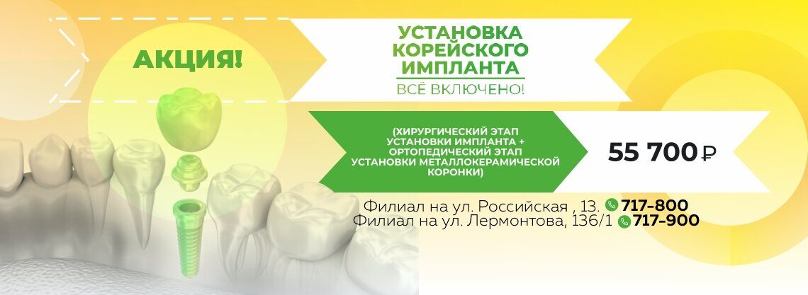 АКЦИЯ НА УСТАНОВКУ ИМПЛАНТОВ